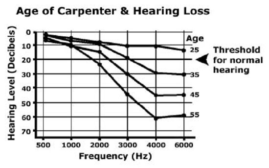 Age of Carpenter & Hearing Loss graph