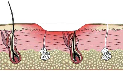 eLCOSH : Cement Hazards and Controls Health Risks and Precautions in