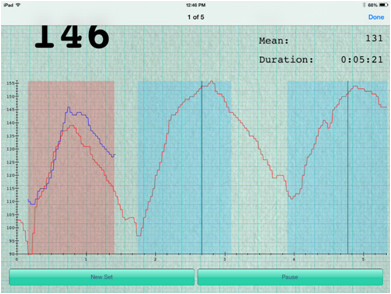 Examples of Heart Rate Results